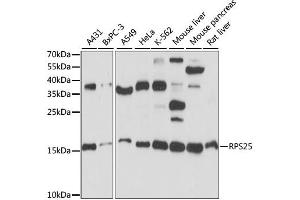 Western blot analysis of extracts of various cell lines, using RPS25 antibody.