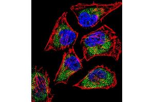 Fluorescent confocal image of Hela cell stained with SIX5 Antibody (Center) (ABIN656668 and ABIN2845908). (Six5 Antikörper  (AA 257-286))