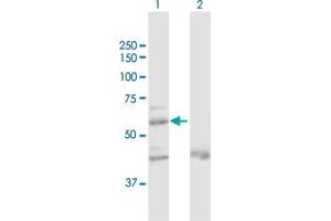 Western Blot analysis of ZNF92 expression in transfected 293T cell line by ZNF92 MaxPab polyclonal antibody. (ZNF92 Antikörper  (AA 1-517))