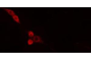 ABIN6274665 staining HepG2 cells by IF/ICC. (DNAJB4 Antikörper  (Internal Region))