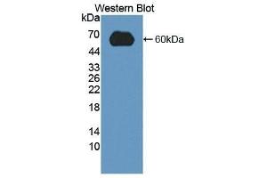Western Blotting (WB) image for anti-Low Density Lipoprotein Receptor (LDLR) (AA 263-509) antibody (ABIN1868940) (LDLR Antikörper  (AA 263-509))