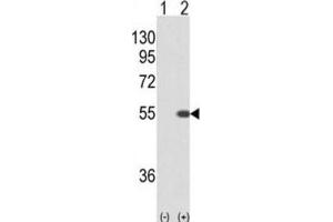 Western Blotting (WB) image for anti-serine/threonine Kinase 40 (STK40) antibody (ABIN3004006) (STK40 Antikörper)