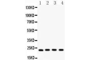 Anti- BAK Picoband antibody, Western blotting All lanes: Anti BAK  at 0. (BAK1 Antikörper  (AA 22-211))