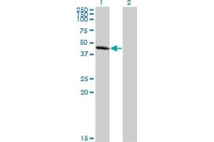 Western Blot analysis of CCBP2 expression in transfected 293T cell line by CCBP2 MaxPab polyclonal antibody. (CCBP2 Antikörper  (AA 1-384))