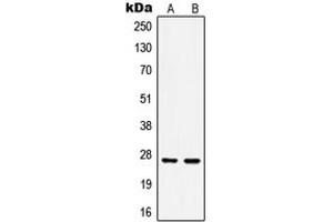 Western blot analysis of HSP27 (pS15) expression in HeLa Anisomycin-treated (A), MCF7 (B) whole cell lysates.