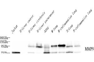 Western Blotting (WB) image for anti-Matrix Metallopeptidase 9 (Gelatinase B, 92kDa Gelatinase, 92kDa Type IV Collagenase) (MMP9) antibody (ABIN7249786)