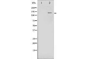 Western blot analysis of FGFR1 phosphorylation expression in Insulin treated 293 whole cell lysates,The lane on the left is treated with the antigen-specific peptide. (FGFR1 Antikörper  (pTyr654))