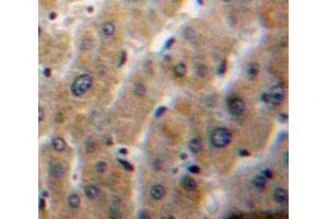 IHC-P analysis of Liver tissue, with DAB staining. (PLA1A Antikörper  (AA 148-295))