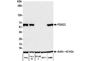 Western Blotting (WB) image for anti-Forkhead Box C2 (MFH-1, Mesenchyme Forkhead 1) (FOXC2) (AA 215-265) antibody (ABIN7453342)