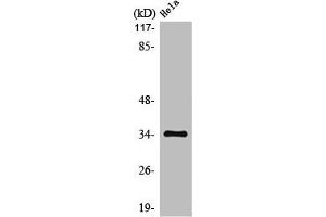 Western Blot analysis of HeLa cells using MC2-R Polyclonal Antibody (MC2R Antikörper  (C-Term))