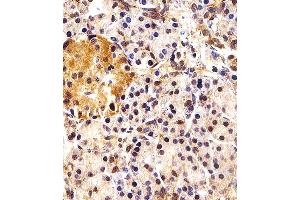Immunohistochemical analysis of paraffin-embedded H. (ING4 Antikörper  (C-Term))
