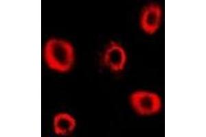 Immunofluorescent analysis of RRM2 staining in Hela cells. (RRM2 Antikörper)