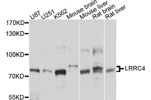 Western blot analysis of extracts of various cell lines, using LRRC4 antibody. (LRRC4 Antikörper)