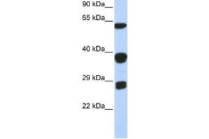 Western Blotting (WB) image for anti-Small Nuclear Ribonucleoprotein Polypeptides B and B1 (SNRPB) antibody (ABIN2458499) (SNRPB Antikörper)