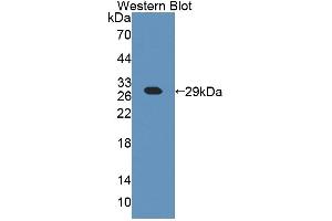 Detection of Recombinant CHN2, Mouse using Polyclonal Antibody to Chimerin 2 (CHN2) (CHN2 Antikörper  (AA 101-323))