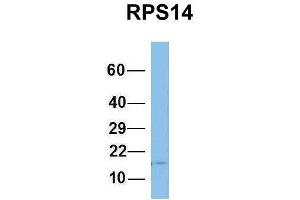 Host:  Rabbit  Target Name:  RPS14  Sample Type:  Human Fetal Brain  Antibody Dilution:  1. (RPS14 Antikörper  (Middle Region))
