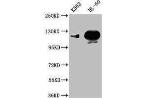 Western Blot Positive WB detected in: K562 whole cell lysate,HL-60 whole cell lysate All lanes: POTEE antibody at 1:1000 Secondary Goat polyclonal to rabbit IgG at 1/50000 dilution Predicted band size: 122 kDa Observed band size: 122 kDa (POTEE Antikörper  (AA 435-606))