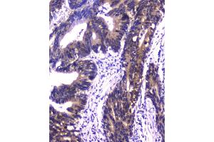 IHC analysis of PPID using anti-PPID antibody (ABIN6719438).