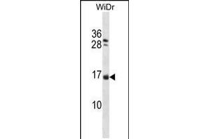 Western blot analysis in WiDr cell line lysates (35ug/lane). (NHLH1 Antikörper  (AA 38-67))