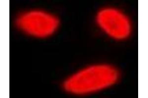 Immunofluorescent analysis of ERK5 staining in K562 cells.