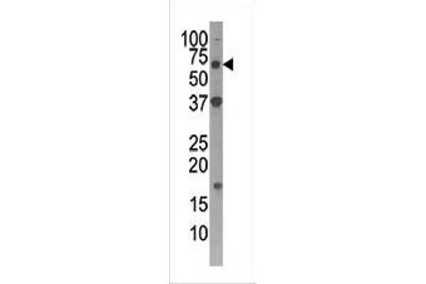 ATG4D Antikörper  (C-Term)