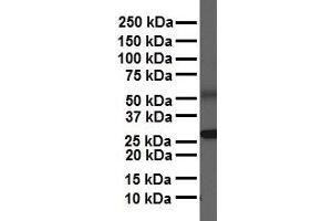 WB Suggested Anti-NR5A1 antibody Titration: 1 ug/mL Sample Type: Human heart