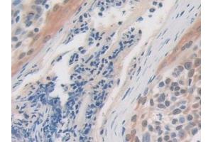Immunohistochemistry (IHC) image for anti-Ubiquitin Specific Peptidase 7 (Herpes Virus-Associated) (USP7) (AA 54-507) antibody (ABIN7443551)