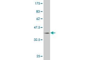 Western Blot detection against Immunogen (36. (CITED1 Antikörper  (AA 94-193))