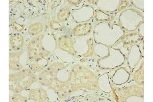 Immunohistochemistry (IHC) image for anti-CD14 (CD14) antibody (ABIN7140933)
