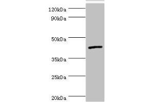 Western blot All lanes: Interleukin-13 receptor subunit alpha-2 antibody at 5 μg/mL + Hela whole cell lysate Secondary Goat polyclonal to rabbit IgG at 1/10000 dilution Predicted band size: 44 kDa Observed band size: 44 kDa (IL13RA2 Antikörper  (AA 27-343))