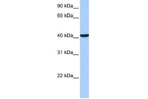 WB Suggested Anti-CC2D1B Antibody Titration: 0.