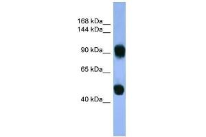 Human Muscle; WB Suggested Anti-AP1B1 Antibody Titration: 0.