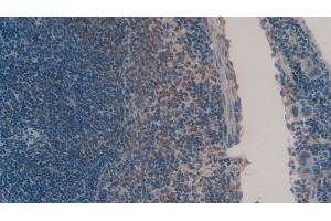 Detection of CHEM in Mouse Spleen Tissue using Polyclonal Antibody to Chemerin (CHEM) (Chemerin Antikörper  (AA 21-155))