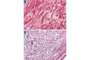 Immunohistochemistry (Formalin/PFA-fixed paraffin-embedded sections) of human prostate, smooth muscle (A) and human colon, smooth muscle (B) with ELTD1 polyclonal antibody . (ELTD1 Antikörper  (N-Term))