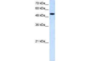 Western Blotting (WB) image for anti-Solute Carrier Family 25 (Mitochondrial Carrier, Phosphate Carrier), Member 25 (SLC25A25) antibody (ABIN2462730) (SLC25A25 Antikörper)