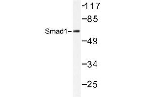 Image no. 2 for anti-SMAD, Mothers Against DPP Homolog 1 (SMAD1) antibody (ABIN272123) (SMAD1 Antikörper)