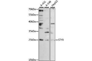 Western blot analysis of extracts of various cell lines, using STYX antibody (ABIN6293959) at 1:1000 dilution. (STYX Antikörper)
