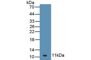 Western Blotting (WB) image for anti-Angiotensin II Receptor, Type 2 (AGTR2) antibody (ABIN7432955)