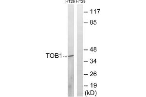 Western blot analysis of extracts from HT-29 cells, treated with serum (20%, 15mins), using TOB1 (Phospho-Ser164) antibody. (Protein Tob1 (TOB1) (pSer164) Antikörper)