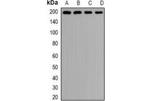 Western blot analysis of Clathrin Heavy Chain expression in Hela (A), MCF7 (B), mouse lung (C), rat brain (D) whole cell lysates.