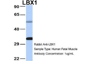 Host: Rabbit Target Name: LBX1 Sample Type: Human Fetal Muscle Antibody Dilution: 1.