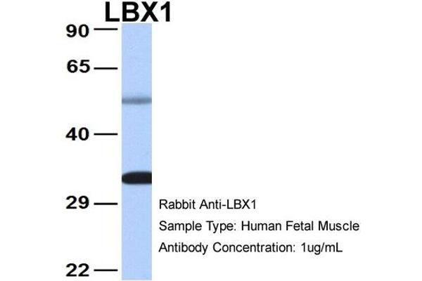 Lbx1 抗体  (Middle Region)