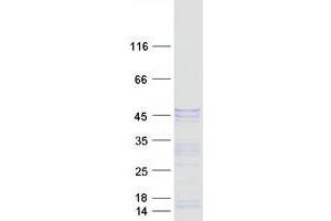 Western Blotting (WB) image for Doublecortin (DCX) (Transcript Variant 4) protein (Myc-DYKDDDDK Tag) (ABIN2719681)
