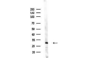 anti-RASH/RASK/RASN (N-Term) antibody