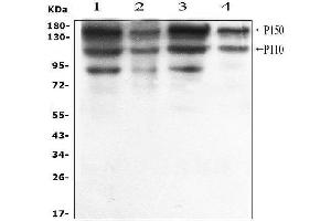 Western blot analysis of ADAR1 using anti-ADAR1 antibody (ABIN4886426).