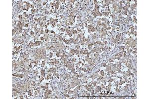 IHC analysis of ODF2L using anti-ODF2L antibody (ABIN7601202). (ODF2L Antikörper  (AA 3-610))