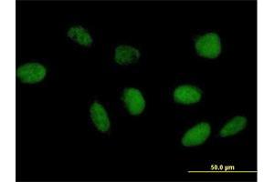 Immunofluorescence of purified MaxPab antibody to TAF6L on HeLa cell. (TAF6L Antikörper  (AA 1-459))