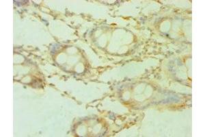 Immunohistochemistry of paraffin-embedded human colon tissue using ABIN7168889 at dilution of 1:100 (SHMT1 Antikörper  (AA 324-483))
