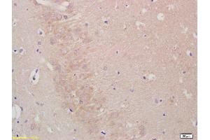 Formalin-fixed and paraffin embedded rat brain labeled with Anti--LIS1 Polyclonal Antibody, Unconjugated (ABIN676868) at 1:200, followed by conjugation to the secondary antibody and DAB staining (PAFAH1B1 Antikörper  (AA 311-410))
