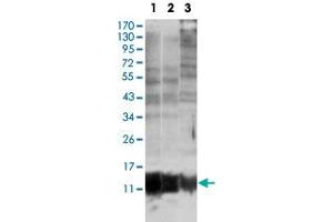 Western blot analysis of S100A10 monoclonal antobody, clone 4E7E10  against MCF-7 (1), HepG2 (2) and HeLa (3). (S100A10 Antikörper)